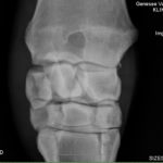 Knee Xray Horse Knee Blow Out